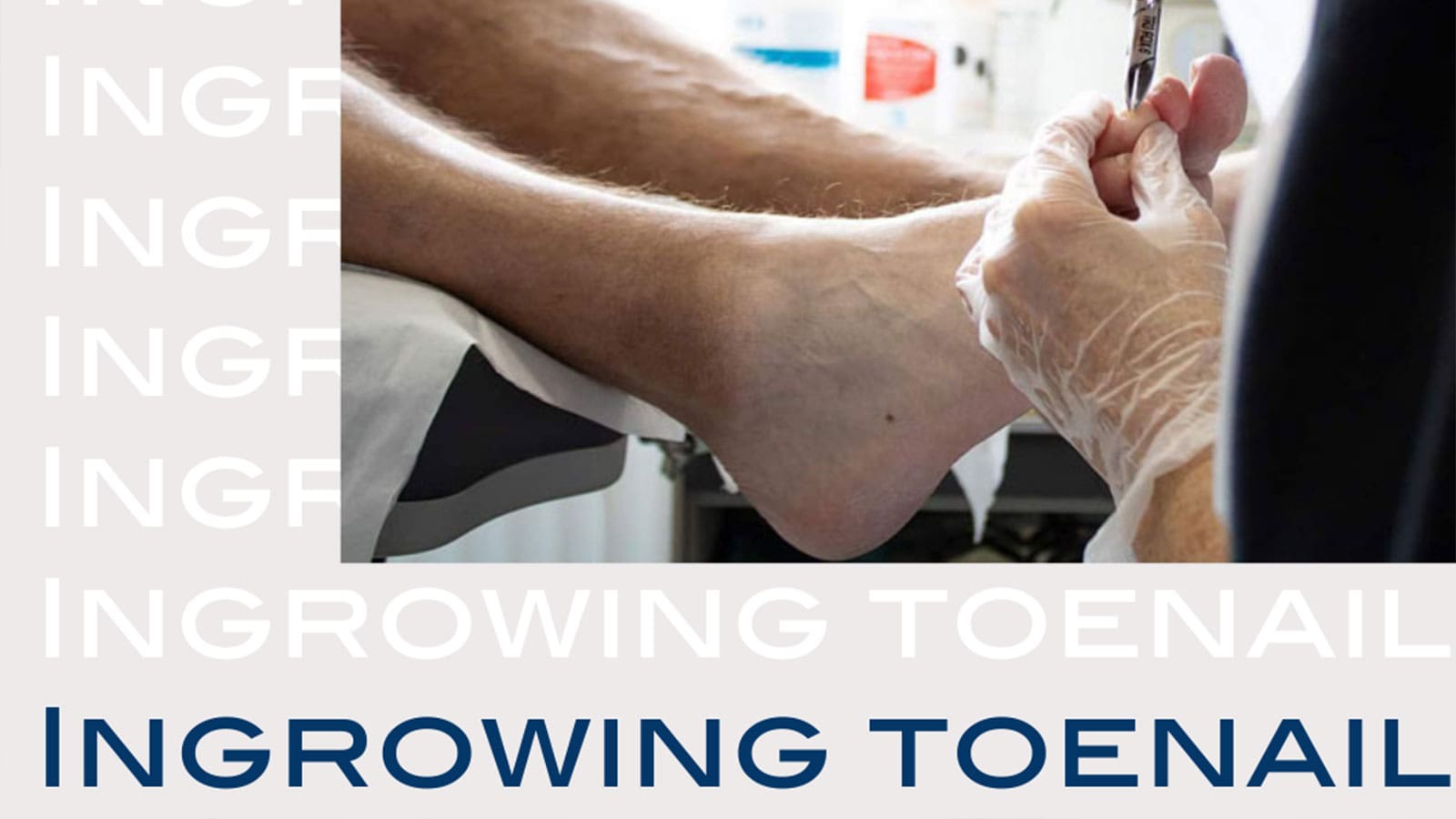 Now Is The Time For Ingrowing Toenail Surgery | The Nantwich Clinic | Health Care & Self Care | Nantwich | Cheshire